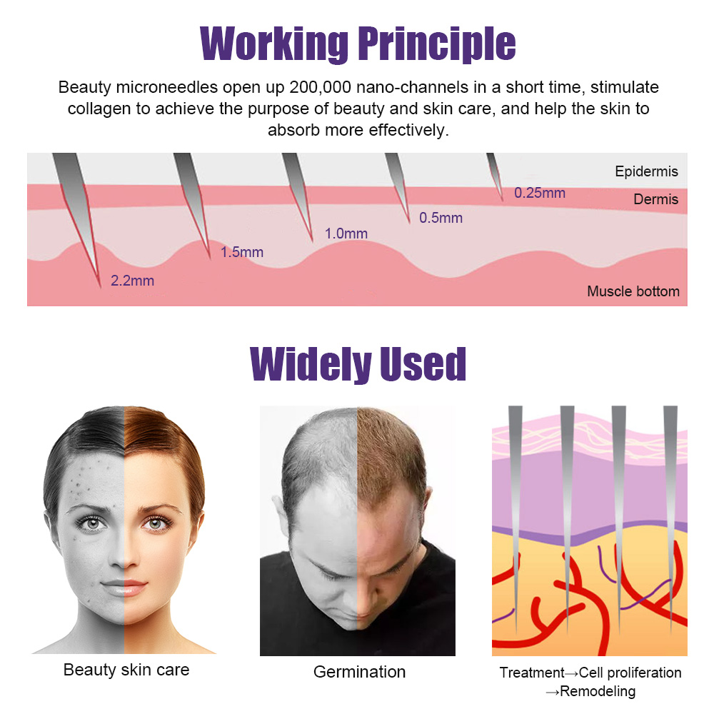 Natural Men Beard Growth Derma - Derma Roller 0.25 recensie en prijs